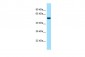 CDK5RAP3 antibody - N-terminal region
